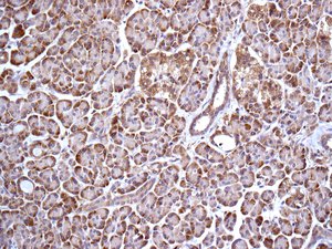 Immunohistochemistry (Formalin/PFA-fixed paraffin-embedded sections) - Anti-GNAI2 antibody [EPR9469] (AB157204), expandable thumbnail