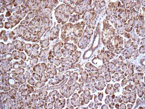 Immunohistochemistry (Formalin/PFA-fixed paraffin-embedded sections) - Anti-GNAI2 antibody [EPR9469] (AB157204)