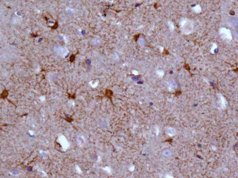 Immunohistochemistry (Formalin/PFA-fixed paraffin-embedded sections) - Anti-GNAI2 antibody [EPR9469] (AB157204), expandable thumbnail