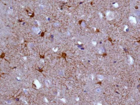 Immunohistochemistry (Formalin/PFA-fixed paraffin-embedded sections) - Anti-GNAI2 antibody [EPR9469] - BSA and Azide free (AB240140)