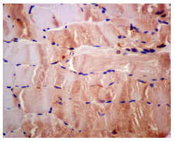 Immunohistochemistry (Formalin/PFA-fixed paraffin-embedded sections) - Anti-GNAI3 antibody [EPR11900] - BSA and Azide free (AB249914)