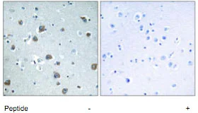 Immunohistochemistry (Formalin/PFA-fixed paraffin-embedded sections) - Anti-GNAL antibody (AB74049)