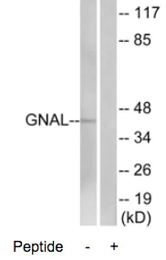 Western blot - Anti-GNAL antibody (AB74049)