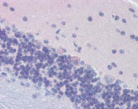 Immunohistochemistry (Formalin/PFA-fixed paraffin-embedded sections) - Anti-GNAO1 antibody (AB117273), expandable thumbnail