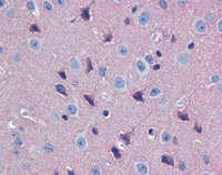 Immunohistochemistry (Formalin/PFA-fixed paraffin-embedded sections) - Anti-GNAO1 antibody (AB117273), expandable thumbnail