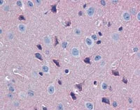 Immunohistochemistry (Formalin/PFA-fixed paraffin-embedded sections) - Anti-GNAO1 antibody (AB117273)