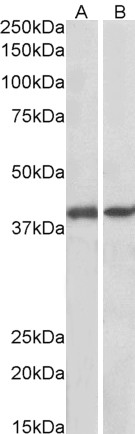 Western blot - Anti-GNAQ antibody (AB113429)