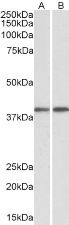 Western blot - Anti-GNAQ antibody (AB113429)