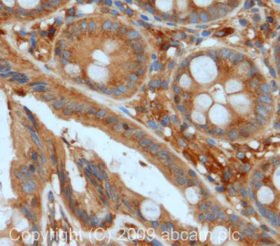 Immunohistochemistry (Formalin/PFA-fixed paraffin-embedded sections) - Anti-GNAQ antibody (AB75825)