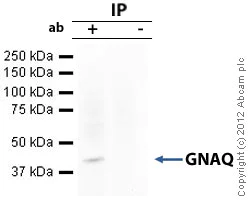 Immunoprecipitation - Anti-GNAQ antibody (AB75825)