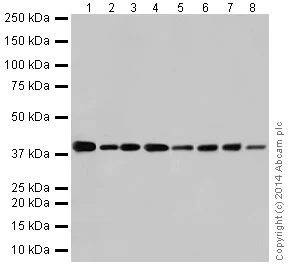 Western blot - Anti-GNAQ antibody [EPR17149] - BSA and Azide free (AB251282)