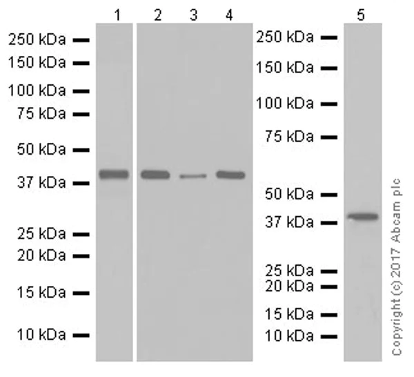 Western blot - Anti-GNAQ antibody [EPR20978] (AB210004)