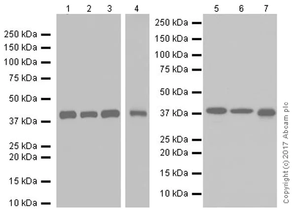 Western blot - Anti-GNAQ antibody [EPR20978] (AB210004)