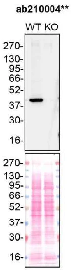Western blot - Anti-GNAQ antibody [EPR20978] - BSA and Azide free (AB225744)