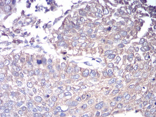 Immunohistochemistry (Formalin/PFA-fixed paraffin-embedded sections) - Anti-GNAS antibody [2A2B7] (AB204996)