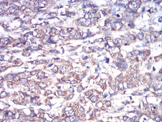 Immunohistochemistry (Formalin/PFA-fixed paraffin-embedded sections) - Anti-GNAS antibody [2A2B7] (AB204996)