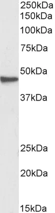 Western blot - Anti-GNAS antibody (AB101736)