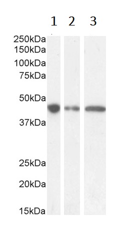 Western blot - Anti-GNAS antibody (AB101736), expandable thumbnail