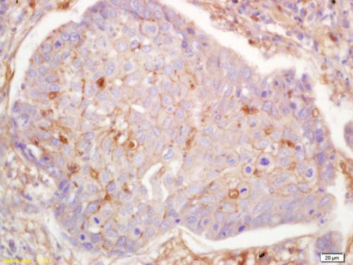Immunohistochemistry (Formalin/PFA-fixed paraffin-embedded sections) - Anti-GNAS antibody (AB203194)
