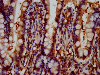 Immunohistochemistry (Formalin/PFA-fixed paraffin-embedded sections) - Anti-GNAS antibody (AB235959)