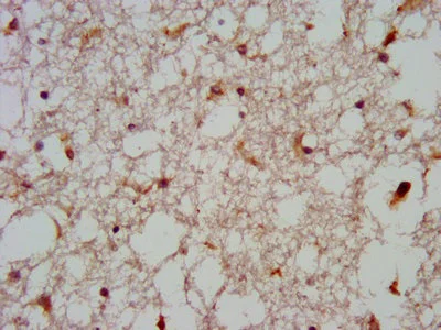 Immunohistochemistry (Formalin/PFA-fixed paraffin-embedded sections) - Anti-GNAS antibody (AB235959)