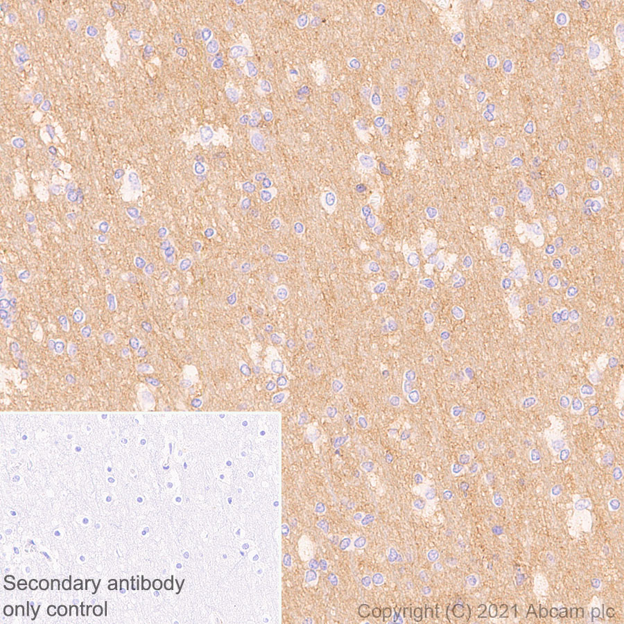 Immunohistochemistry (Formalin/PFA-fixed paraffin-embedded sections) - Anti-GNAS antibody [EPR24177-24] (AB283266)