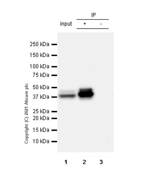 Immunoprecipitation - Anti-GNAS antibody [EPR24177-24] - BSA and Azide free (AB283287)