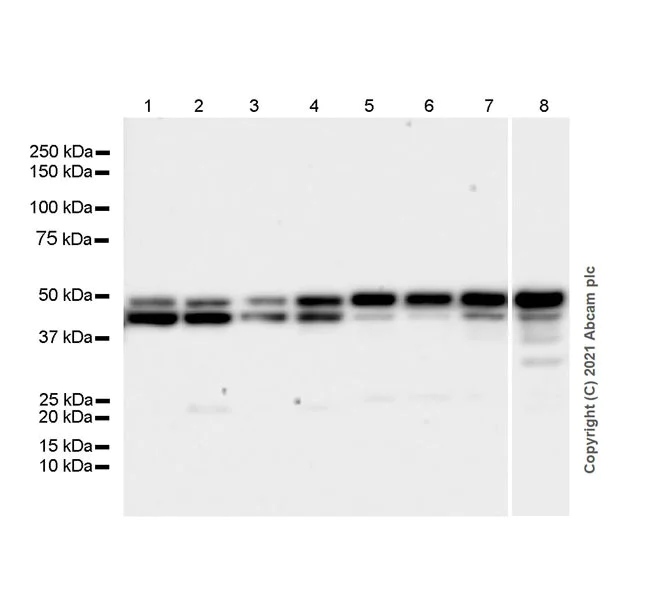 Western blot - Anti-GNAS antibody [EPR24177-24] - BSA and Azide free (AB283287)