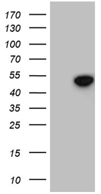 Western blot - Anti-GNAS antibody [OTI7D7] - BSA and Azide free (AB273662)