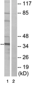 Western blot - Anti-GNAT1 antibody (AB74059)