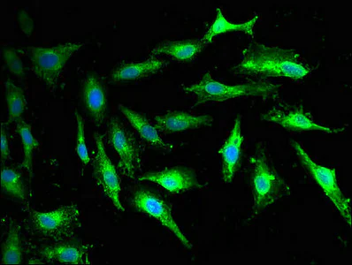 Immunocytochemistry/ Immunofluorescence - Anti-GNAZ antibody (AB229938)