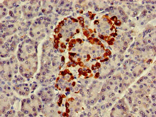 Immunohistochemistry (Formalin/PFA-fixed paraffin-embedded sections) - Anti-GNAZ antibody (AB229938)