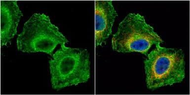 Immunocytochemistry/ Immunofluorescence - Anti-GNB1 antibody (AB137635)