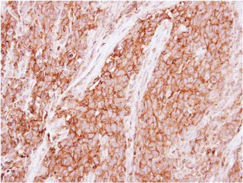 Immunohistochemistry (Formalin/PFA-fixed paraffin-embedded sections) - Anti-GNB1 antibody (AB137635)