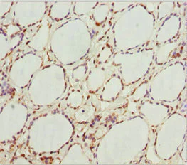 Immunohistochemistry (Formalin/PFA-fixed paraffin-embedded sections) - Anti-GNB1L/GY2 antibody (AB234648)