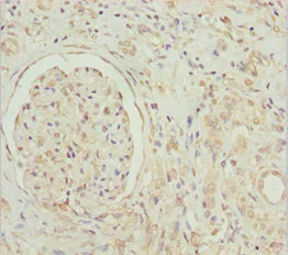 Immunohistochemistry (Formalin/PFA-fixed paraffin-embedded sections) - Anti-GNB1L/GY2 antibody (AB234648)