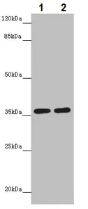 Western blot - Anti-GNB1L/GY2 antibody (AB234648)
