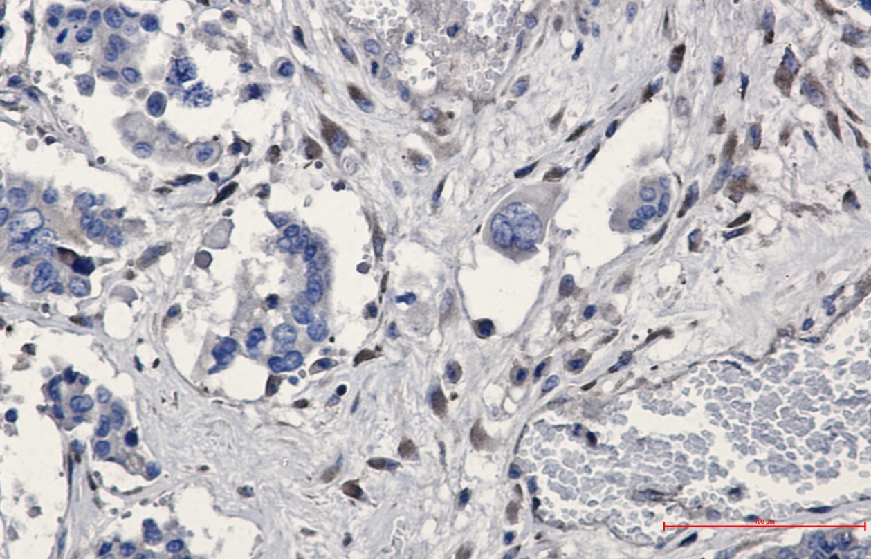 Immunohistochemistry (Formalin/PFA-fixed paraffin-embedded sections) - Anti-GNB2 Antibody [S04-1A2] (AB317373), expandable thumbnail