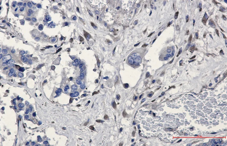 Immunohistochemistry (Formalin/PFA-fixed paraffin-embedded sections) - Anti-GNB2 Antibody [S04-1A2] (AB317373)