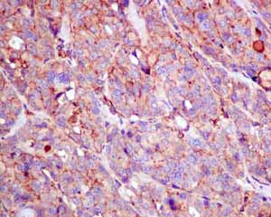 Immunohistochemistry (Formalin/PFA-fixed paraffin-embedded sections) - Anti-GNB3 antibody [EPR8862] (AB154866)