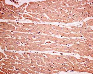 Immunohistochemistry (Formalin/PFA-fixed paraffin-embedded sections) - Anti-GNB3 antibody [EPR8862] (AB154866)