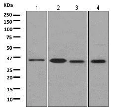 Western blot - Anti-GNB3 antibody [EPR8862] (AB154866)
