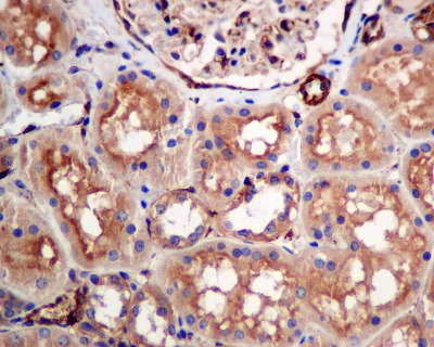 Immunohistochemistry (Formalin/PFA-fixed paraffin-embedded sections) - Anti-GNB3 antibody [EPR8862] - BSA and Azide free (AB249165)