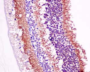 Immunohistochemistry (Formalin/PFA-fixed paraffin-embedded sections) - Anti-GNB3 antibody [EPR8862] - BSA and Azide free (AB249165)