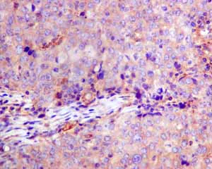 Immunohistochemistry (Formalin/PFA-fixed paraffin-embedded sections) - Anti-GNB3 antibody [EPR8862] - BSA and Azide free (AB249165)