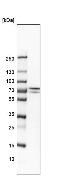 Western blot - Anti-GNE antibody (AB244403)