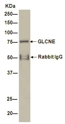 Immunoprecipitation - Anti-GNE antibody [EPR15059] - BSA and Azide free (AB251009)