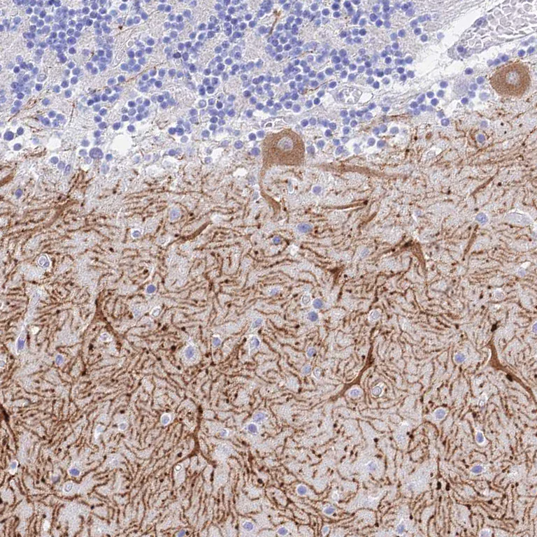 Immunohistochemistry (Formalin/PFA-fixed paraffin-embedded sections) - Anti-GNG13 antibody (AB126562)