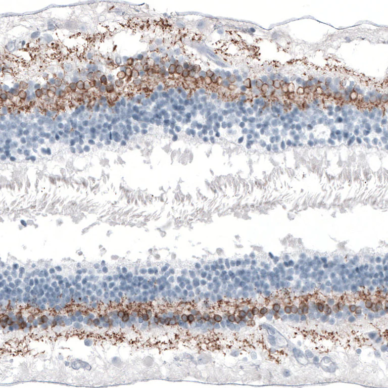 Immunohistochemistry (Formalin/PFA-fixed paraffin-embedded sections) - Anti-GNG13 antibody (AB126562)