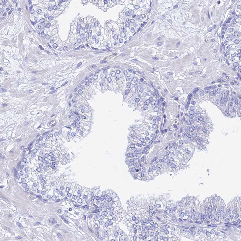 Immunohistochemistry (Formalin/PFA-fixed paraffin-embedded sections) - Anti-GNG13 antibody (AB126562)